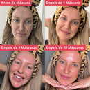 Máscara de Colágeno Profundo+ Ativos do botox.