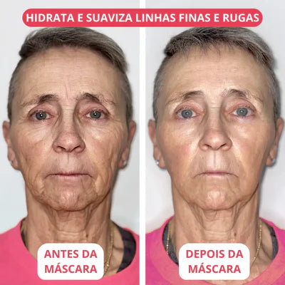 Máscara de Colágeno Profundo+ Ativos do botox.